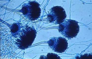 Aspergillus fumigatus